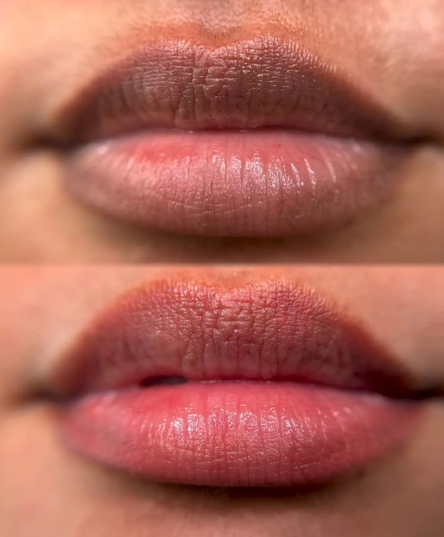 Is Bepanthen Recommended After Microblading?